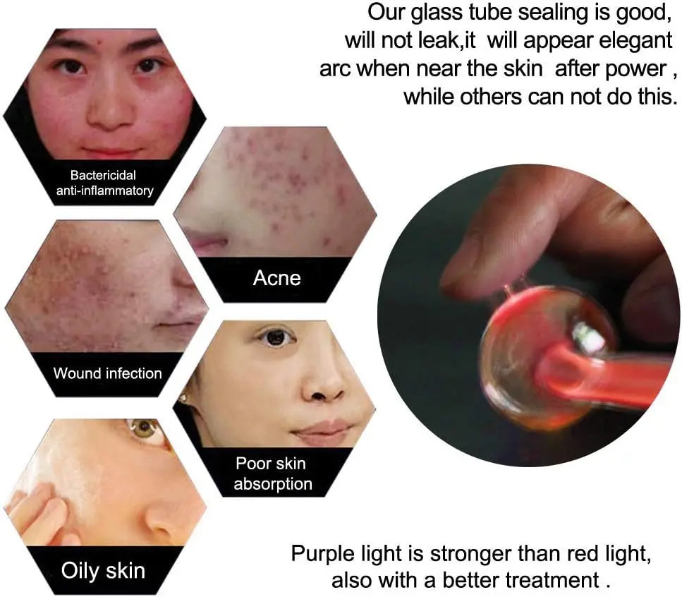 High Frequency Facial Wand Device with Comb Electrodes for Acne Treatment Skin Tightening Hair Growth Scalp Therapy Home Use